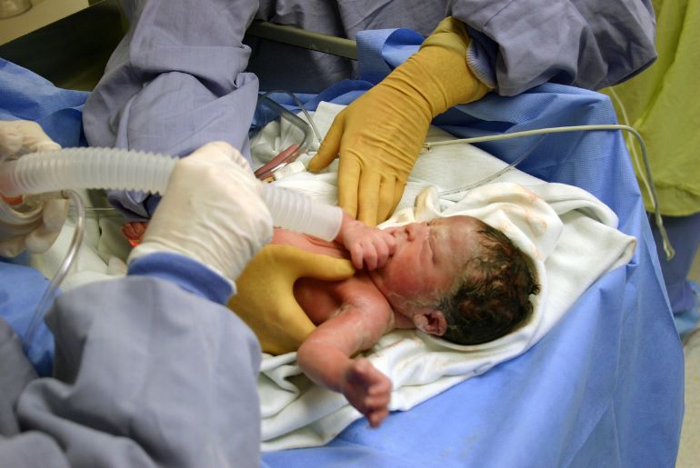Neonatal Surgery