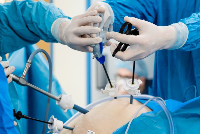 Paediatric Laparoscopic Surgery