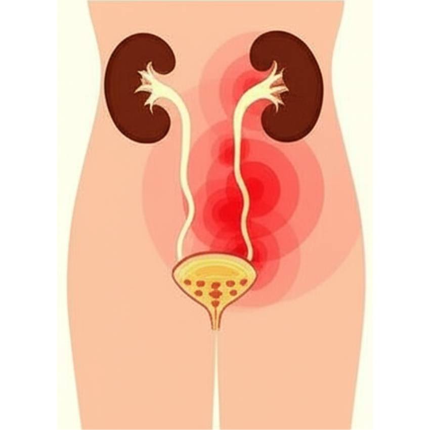 Paediatric Urology Urinary Tract Infections